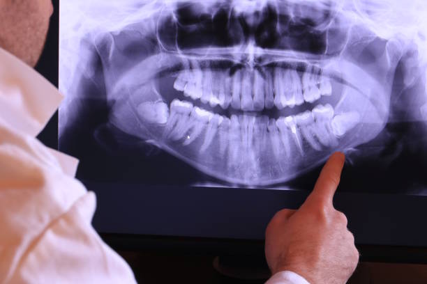 Best Broken or Cracked Tooth Emergency Dentist in Wadesboro, NC
