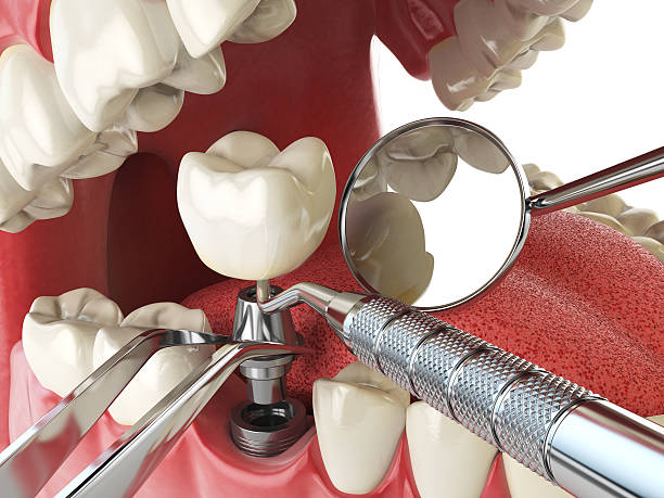 Best Emergency Dentist for Knocked-Out Tooth in Wadesboro, NC