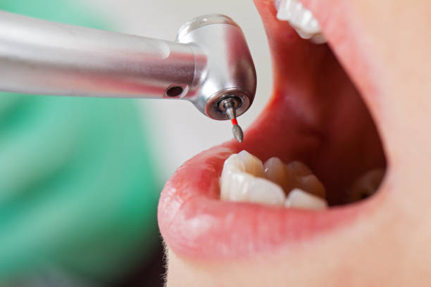 Best Holiday Emergency Dentist in Wadesboro, NC